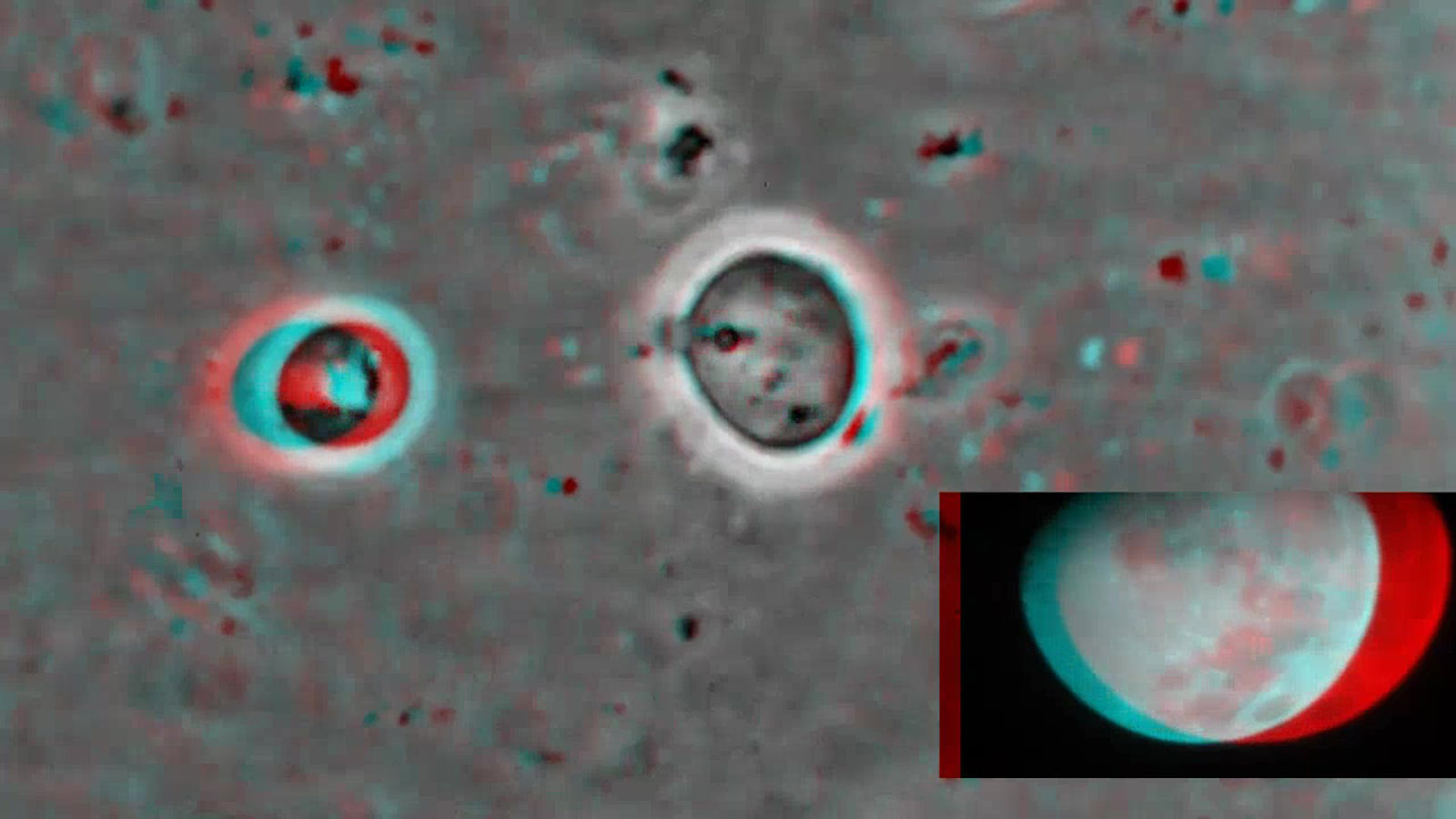 magnification